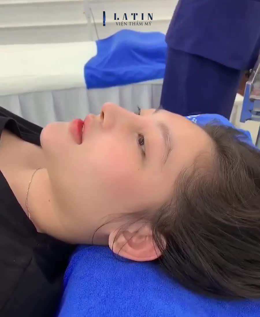 Mũi của em gái 11 ngày!